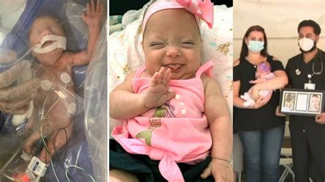 Micro Preemie Baby Born At 1 Pound 8 Ounces Who Spent 122 Days In