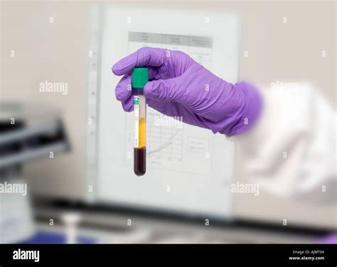 Centrifuged Sample Of Human Blood In Tube Stock Photo Alamy