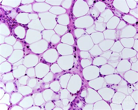 Adipose Tissue By Jose Calvo Science Photo Library