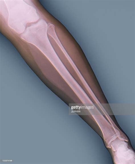 Normal Lower Leg Xray Foto Stock Getty Images