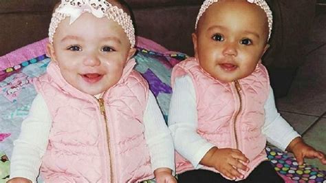 amazing twins who look nothing alike page 34