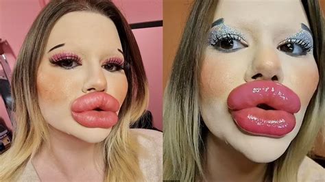 Andrea Ivanova Aims To Get The Worlds Biggest Cheeks After Setting Worlds Biggest Lips Record