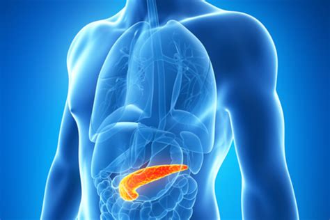 La pancreatite è un'infiammazione del pancreas che. GastroCentro O Que é e Como Tratar a Pancreatite Aguda ...