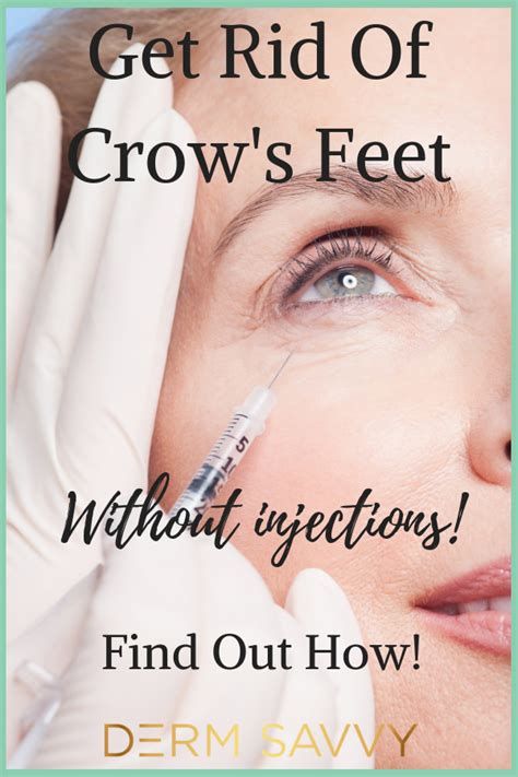 how to easily get rid of crow s feet for good derm savvy crows feet crows feet wrinkles