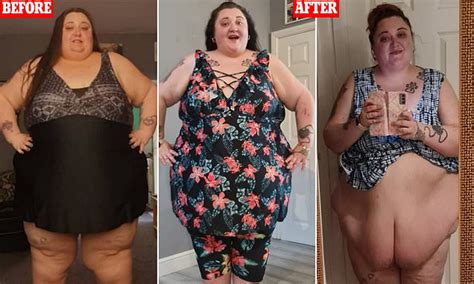Obese Woman Who Lost Stone Wants To Fund A For A Tummy Tuck To Get Rid Of Her Loose