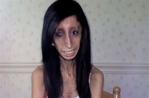 lizzie velasquez with rare syndrome talks about bullying and how to deal with it video boomsbeat