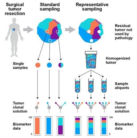 New Tumour Sampling Method Significantly Improves Genetic Testing For