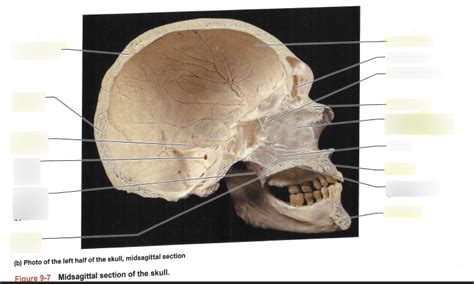 Midsagittal Section Skull Real Diagram Quizlet