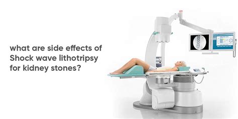 Risks And Side Effects Of Shock Wave Lithotripsy For Kidney Stones