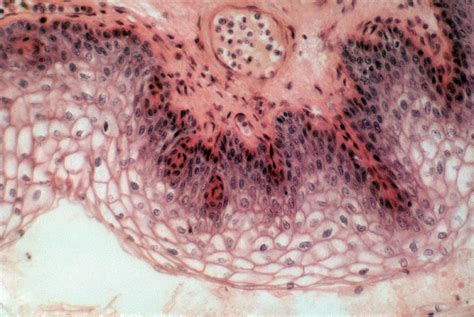 Stratified Squamous Epithelium Lm Photograph By Robert Knauft