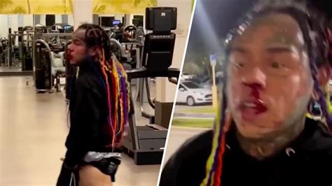 6ix9ine Attack New Video Shows Tekashi 69 After Gym Beating Nbc 6 South Florida