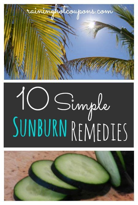 10 Simple Sunburn Remedies Sunburn Remedies Sunburn Natural Wart