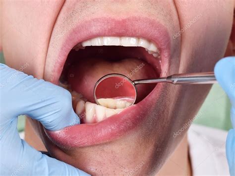 Dentist Examining Patient S Teeth Stock Photo Vetkit