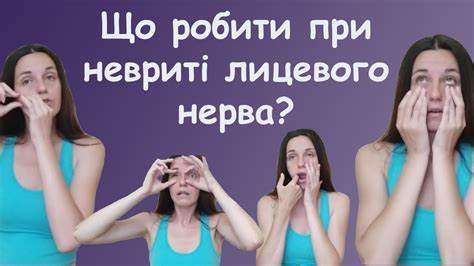 Диета неврит лицевого нерва Неврит лицевого нерва лікування - масаж, вправи. Лічниця сестер Неврит лицевого нерва лікування - масаж, вправи. Лічниця сестер Диета неврит лицевого нерва