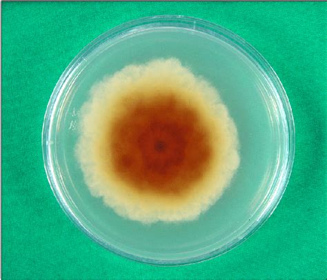 Reverse Surface Of Sabourauds Dextrose Agar Plate After Incubation At