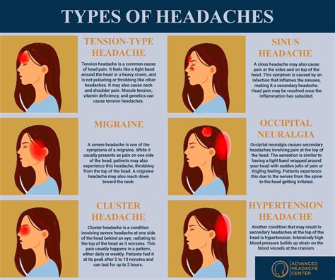 For More Information About The Nyc Headache Center Our Doctors Or To