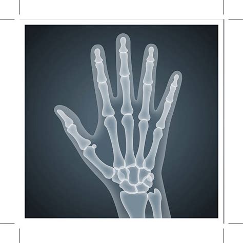 X Ray Image Clip Art Vector Images And Illustrations Istock