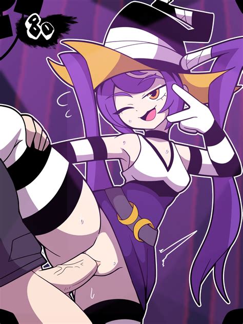 Rule 34 Bandages Clothed Sex Legs Up Legwear Long Gloves One Eye Closed Purple Hair Queen