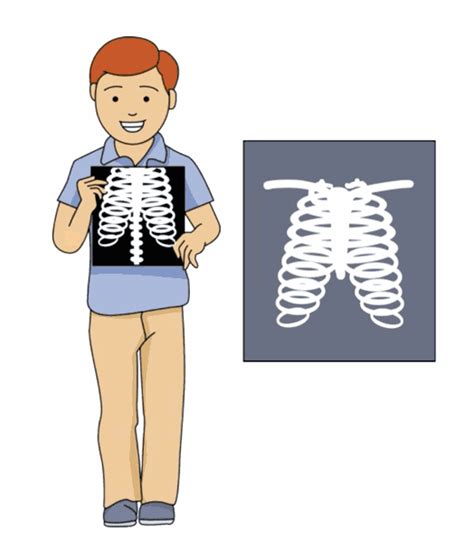 Health Medicine Animated Clipart Boy Holds Up His Xray Animated Clipart