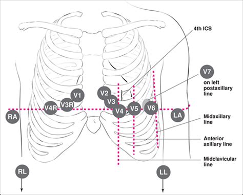 The Electrocardiogram In Infants And Children Obgyn Key