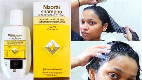 How To Use Nizoral Shampoo For Effective Results Youtube