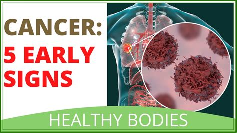 5 Early Cancer Warning Signs Youtube