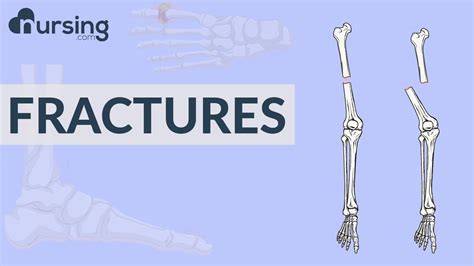 Fractures Nursing Care Youtube