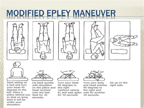 Epley Maneuver Left Ear Pdf Gif