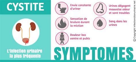 Mis à jour le 15 janvier 2021 5 de nos experts. Infections urinaires chez l'adulte - NEPHROHUG