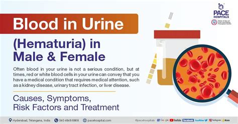 Blood In Urine Hematuria Causes Symptoms And Treatment