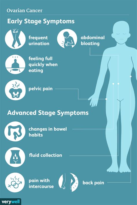 Early ovarian cancer causes minimal, nonspecific, or no symptoms. Ovarian Cancer Definition | Examples and Forms