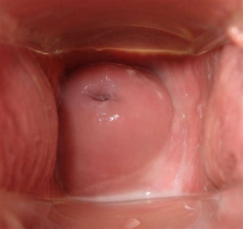 Pictures Inside The Vagina Tumblr