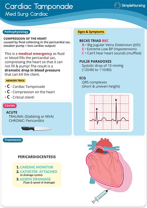 Cardiac Cardiac Tamponade Simple Nursing Nus 211 Dccc Studocu