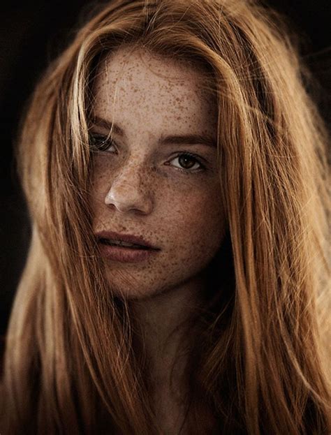 A Woman With Freckled Hair And Freckled Skin Looks Into The Camera