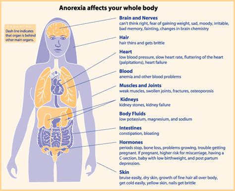 Facts About Anorexia And Bulimia Inform Yourself No