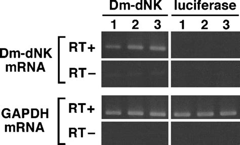 expression of the dm dnk mrna in the transfected hela cells hela cells download scientific