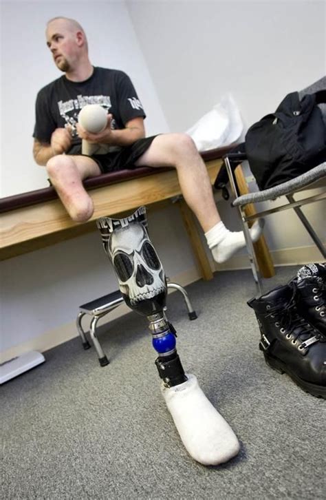 Bob Kislow Arrived On A Harley His High Tech Prosthetic Leg Hidden