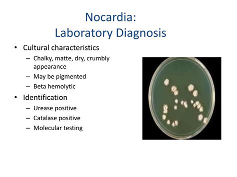 Ppt Gram Positive Bacilli Part Four Powerpoint Presentation Free