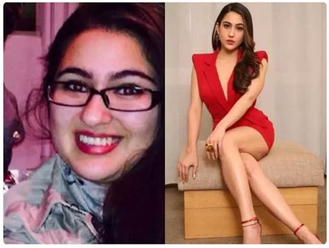Sara Ali Khans Amazing Weight Loss And Battling Pcos Journey Will