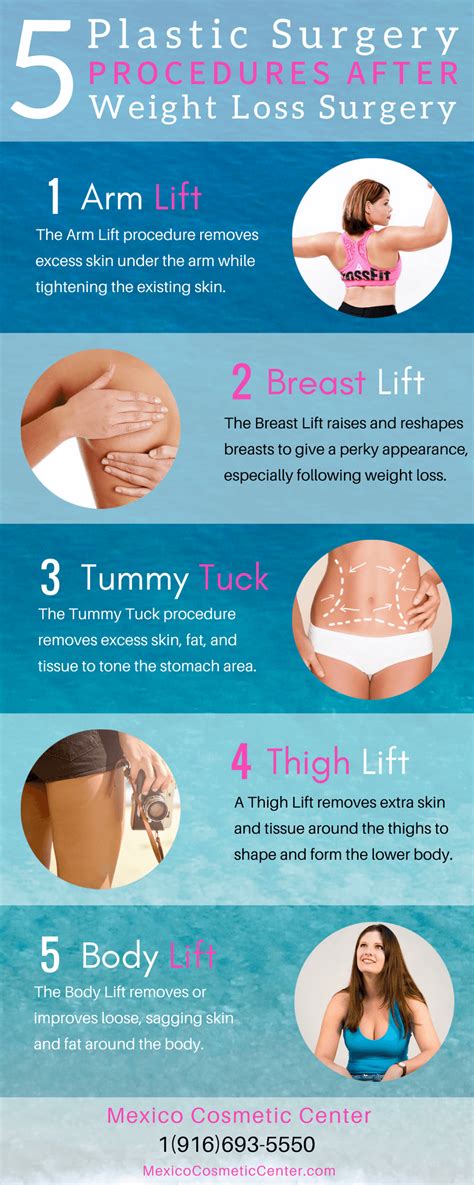 5 Plastic Surgery Procedures After Weight Loss Surgery Infographic