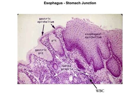 Esophagus Stomach Epithelial Junction Histology Histolog A
