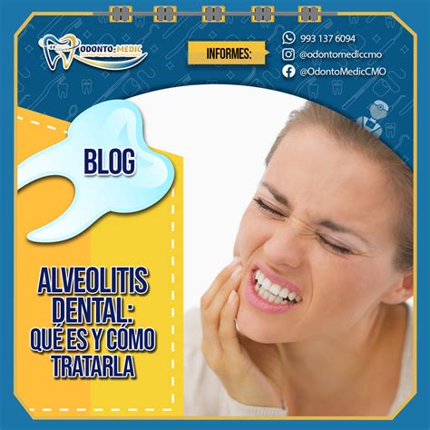 Alveolitis Dental ¿quÉ Es Y CÓmo Tratarlo