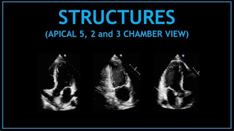 Cardiac Structures Apical 5 2 And 3 Chamber Views Echocardiography