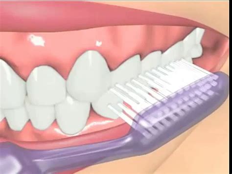 What Is The Bass Tooth Brushing Technique