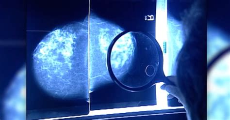 new guidelines on how often to get a mammogram
