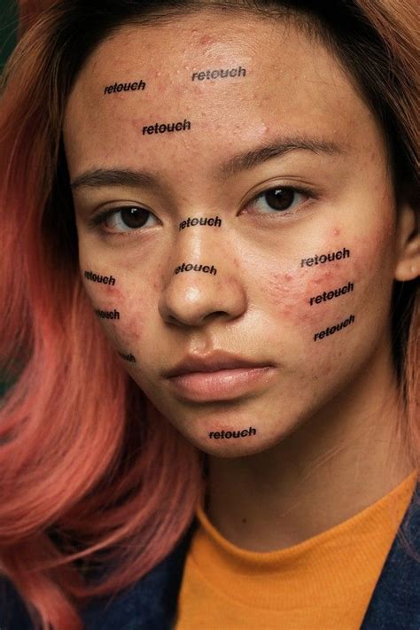 This Photographer Takes Beautiful Portraits Of People With Acne I D Beauty Photography People