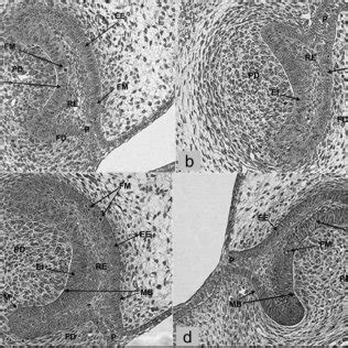 Photomicrograph Of The First Molar Tooth Germ In Rats At Days I U L