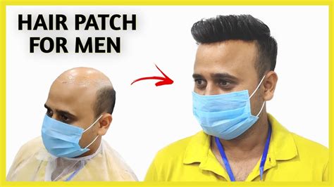 Hair Patch For Men Natural Looking Hair Patch For Men In Delhi🔥 Youtube