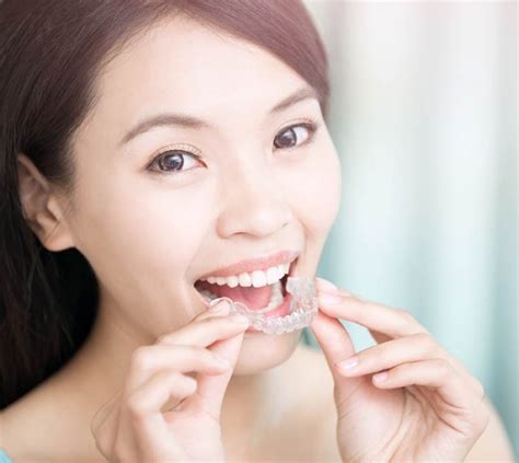 Invisalign Archives Western Ortho