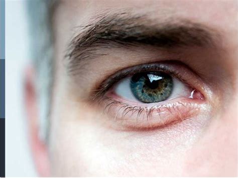 Eye Frecklesiris Freckles Eye Color Inspired Designs